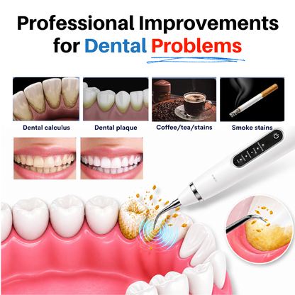 PlaqueLift — Removes Stubborn Plaque & Stains at Home
