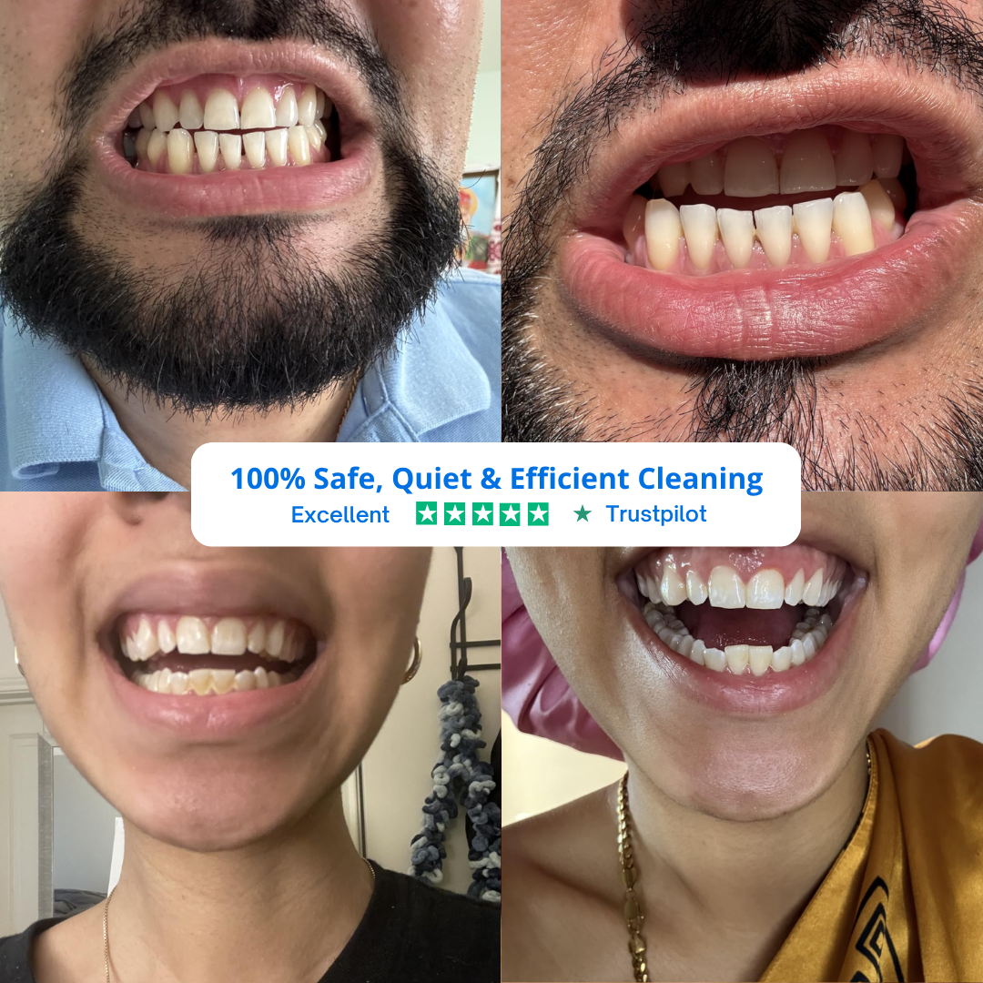 PlaqueLift — Removes Stubborn Plaque & Stains at Home
